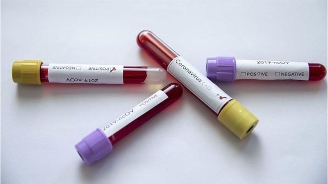 teknobuk-covid19-haber-kapak