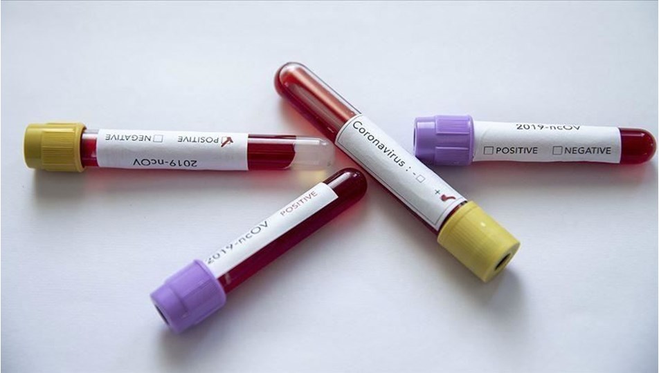 COVID-19 ile Mevsimsel Alerjiler Arasındaki Farklılıklar Nasıl Ayırt Edilir teknobuk-covid19-haber-kapak