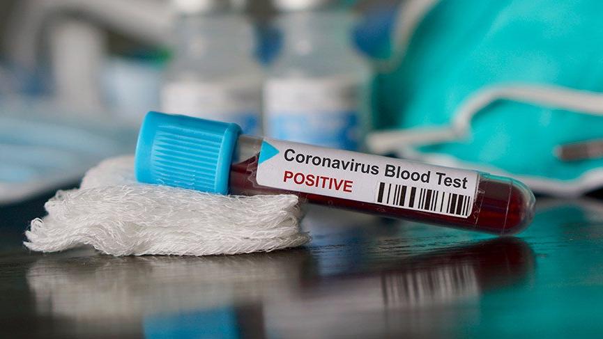 Gizli Veriler Koronavirüs Salgınının Gerçek Hâlini Ortaya Koyuyor