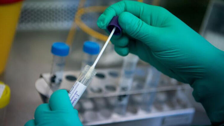 Erken Yapılan RT-PCR Testlerinde Koronavirüs Hatalı Olarak Negatif Çıkabilir